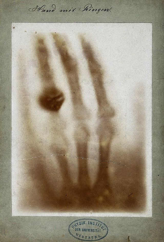 Eerste röntgenfoto, Wilhelm Conrad Röntgen